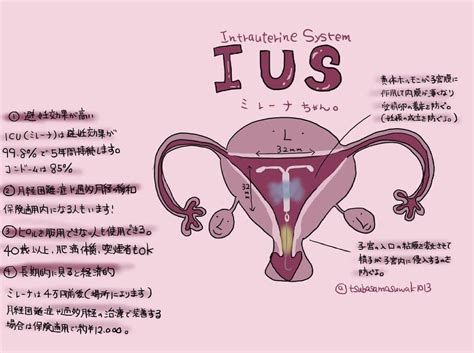 ミレーナ 中だし|ミレーナ (IUS)を着けて中出しをしたら、受精はするのでしょ.